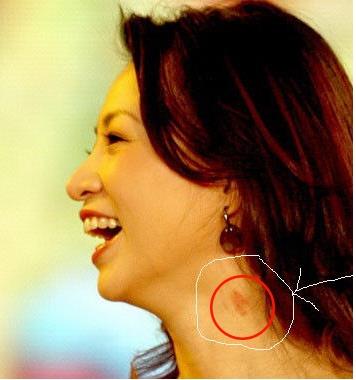 ​脖子有吻痕不小心暴露被拍的9大明星