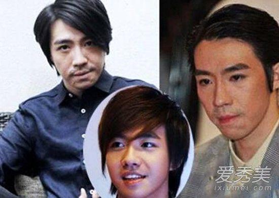 ​俞灏明烧伤后真实素颜照 俞灏明个人资料背景烧伤前后对比
