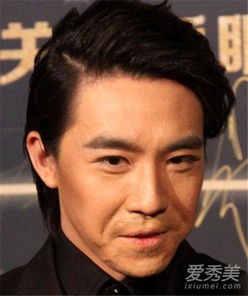 ​俞灏明烧伤后真实素颜照 俞灏明个人资料背景烧伤前后对比