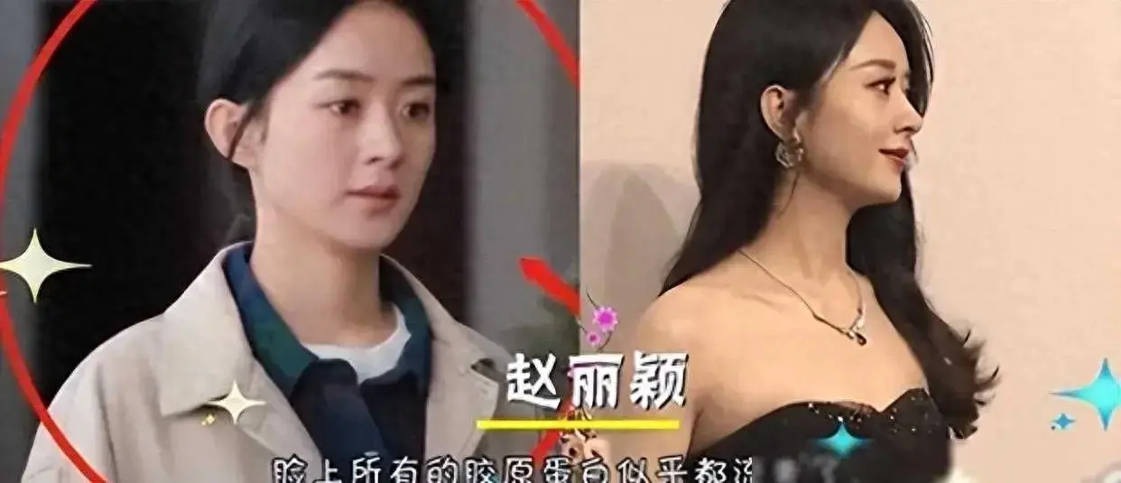 ​有种“整容”叫唐艺昕结婚，老公张若昀变化不大，她却像换了个人